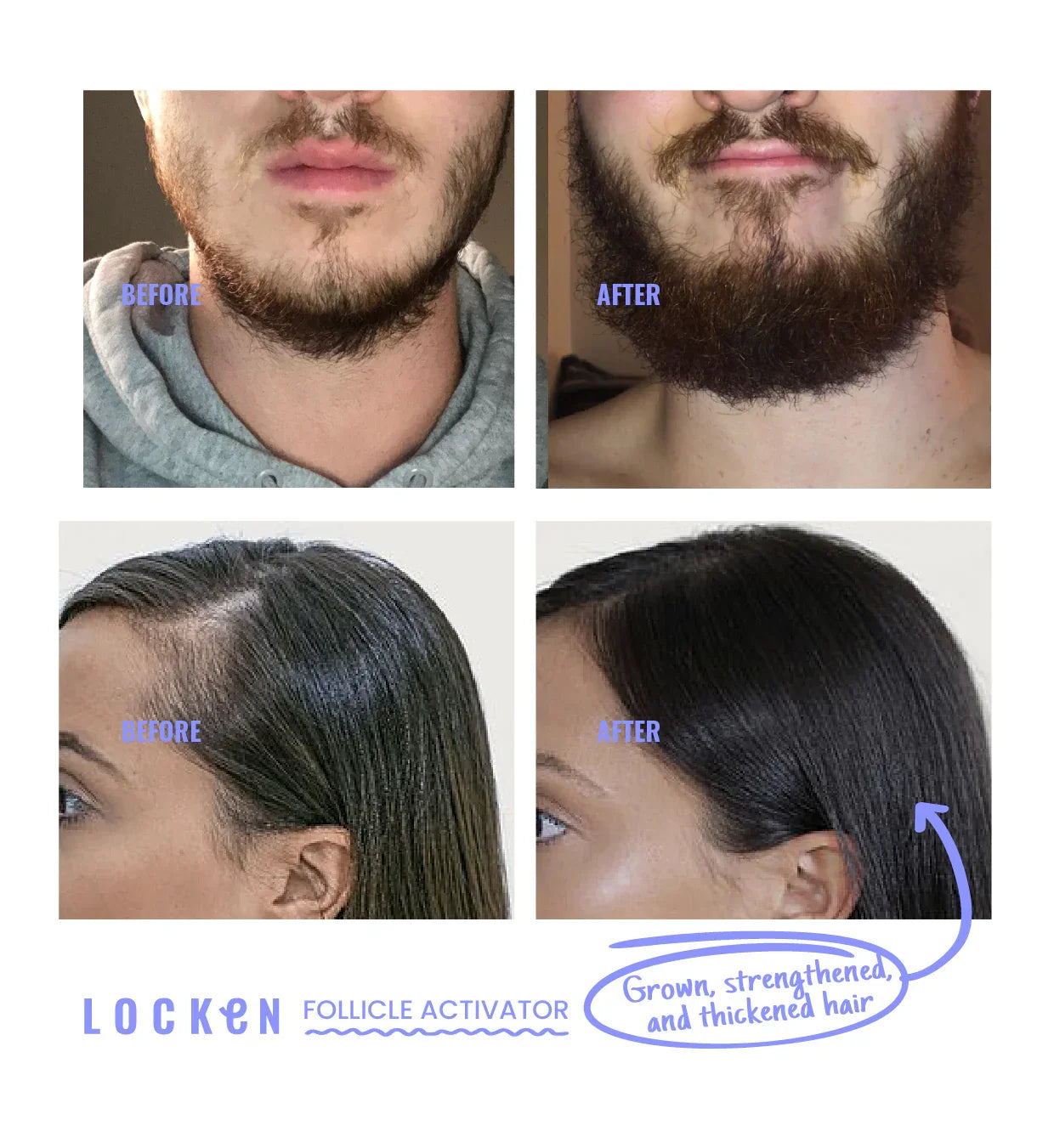 Locken - Rooting For You Follicle Activator 6